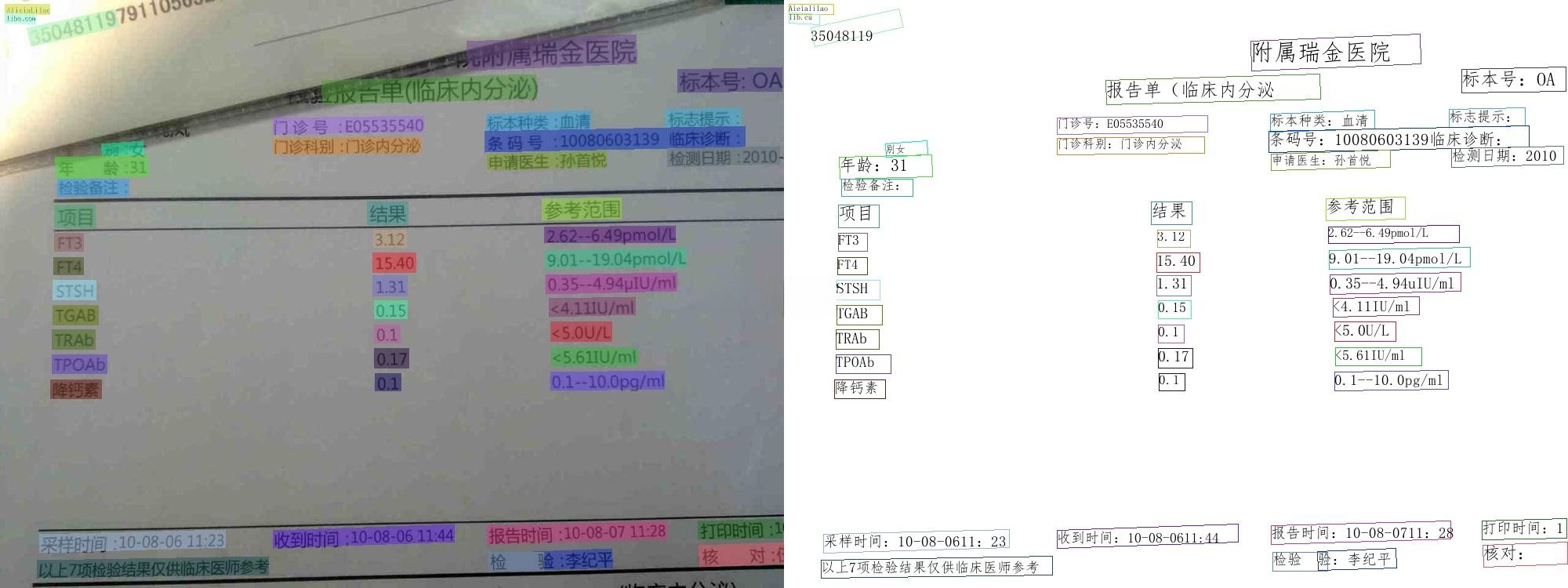 PaddleOCR 2025：最新智能文字识别系统源码下载-七七源码网